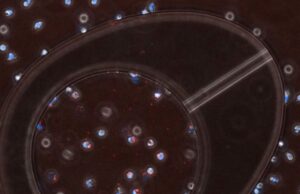 Descubren una forma de aumentar la eficacia de los antibióticos contra las ‘superbacterias’