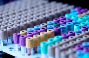 Encuentran muestras olvidadas de un peligroso virus en un laboratorio de EU