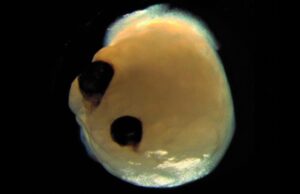 Organoides cerebrales desarrollan “ojos” de forma espontánea