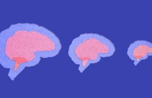 Por qué se ha reducido el tamaño de nuestro cerebro en comparación con el de los neandertales