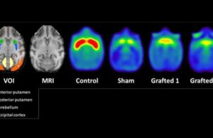 Investigadores mexicanos prueban con éxito trasplante de neuronas en monos para tratar el Parkinson