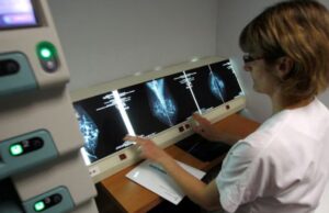 Yale descubre una herramienta de edición genética que frena el crecimiento de cuatro tipos de cáncer diferentes