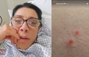 Picadura de araña viuda negra: ¿qué síntomas causa la mordedura como la que sufrió Cynthia Klitbo?