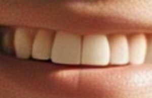 Científicos en Japón Desarrollan un Fármaco para Hacer Crecer una Tercera Dentadura en Adultos