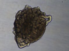 Realizan el primer trasplante en un cerdo de riñones modificados con organoides renales humanos