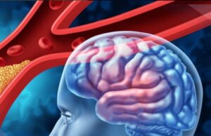 Descubren cómo el cerebro puede regenerar vasos sanguíneos tras un ictus gracias a células gliales