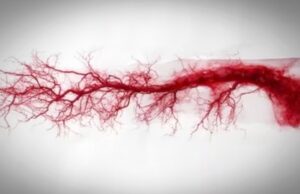 Descubren señales moleculares en el ADN que explican la inflamación crónica de las arterias a partir de los 50 años