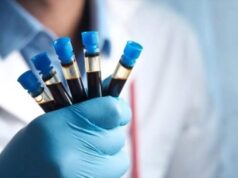 Hemofilia; trastorno de la coagulación que afecta a más de 7 mil mexicanos