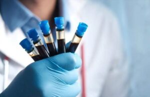 Hemofilia; trastorno de la coagulación que afecta a más de 7 mil mexicanos