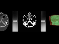 Inteligencia artificial para cirugías más seguras en la cabeza