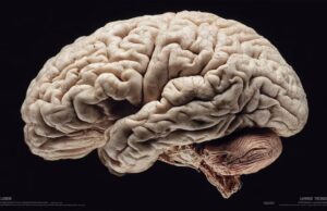 Crean un ‘mapa del dolor’ cerebral que permite aliviar malestares en zonas específicas y sin tratamiento