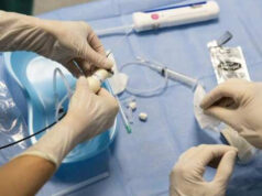 Aguja ultrasónica para extracción de muestras de tejido