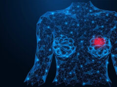 Impulsa la Inteligencia Artificial la detección temprana del cáncer de mama en México